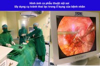 Kịp thời phẫu thuật lấy vòng tránh thai “đi lạc” vào trong ổ bụng
