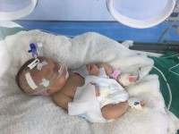Bước tiến trong chăm sóc, nuôi dưỡng trẻ sinh non tại Bệnh viện đa khoa tỉnh Kon Tum