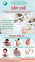 Bài dự thi 03: Cấy chỉ - Bệnh viện YDCT-PHCN